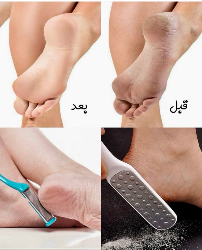 سوهان پا